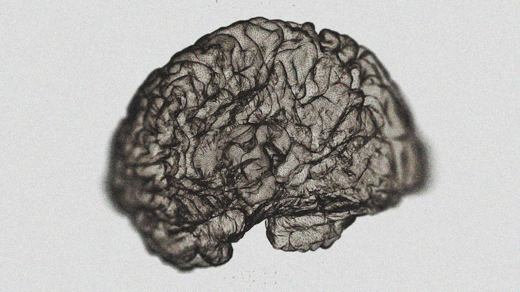 rr-brain-scan